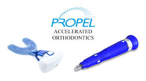 propel accelerated orthodontics